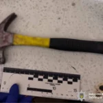 На Київщині чоловік кілька разів вдарив жінку молотком по голові: постраждала у лікарні