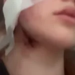 У мережі повідомили про напад на українських дівчину і хлопця у Вроцлаві через акцентУ польському Вроцлаві на українську дівчину і хлопця напали. Потерпілі зазнали тяжких травм, у них підозра на струс мозку.Кримінал • 27 липня, 08:11 • 12354 перегляди