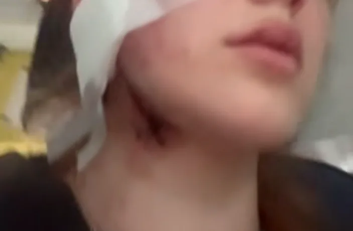 Генконсульство України у Вроцлаві відреагувало на повідомлення про напад на українців і звернулося до поліції Польщі